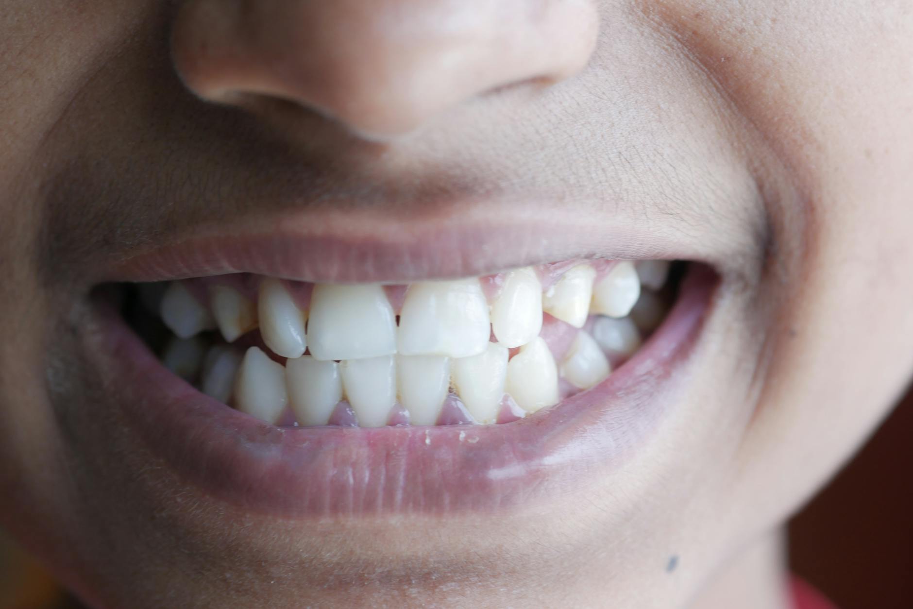 a close up shot of a person s teeth